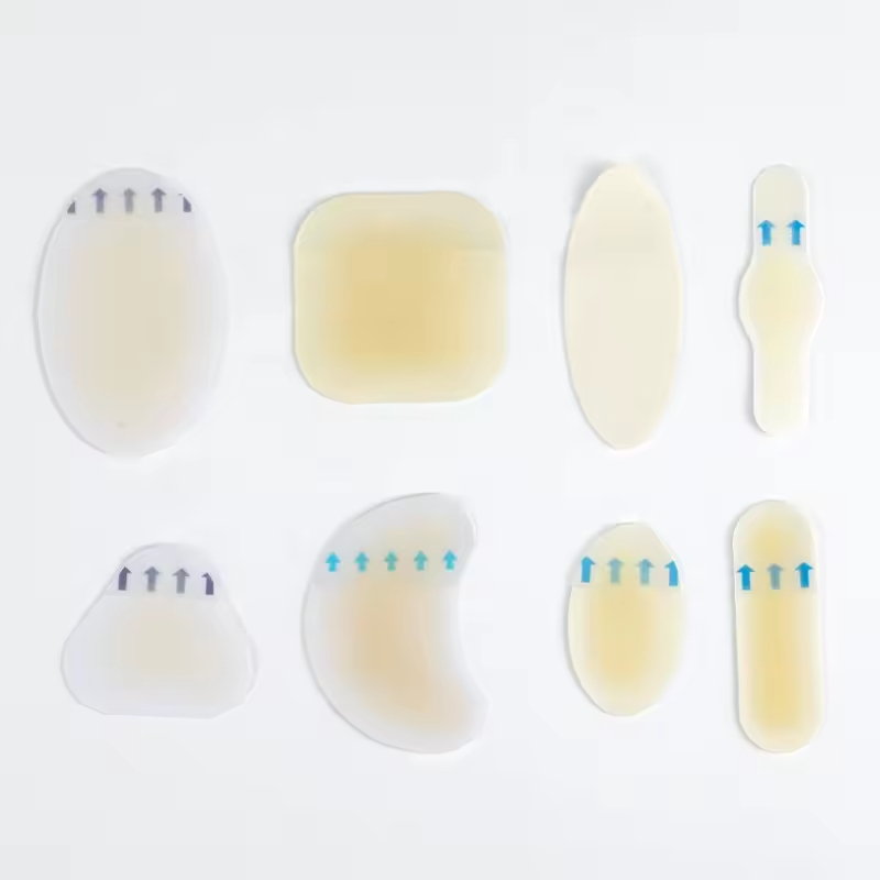 Gesso antibacteriano hidrocolóide para tratamento de feridas