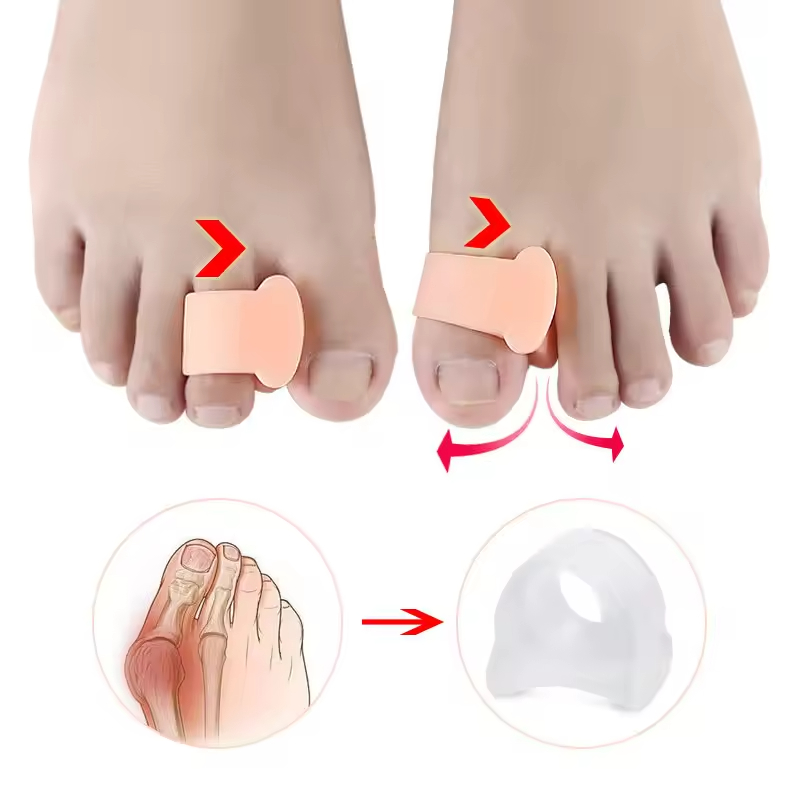 Corretor de dedos de silicone Gel Protetor Separador de dedos Produtos ortopédicos Hallux Valgus Pedicure Foot Care Hammer